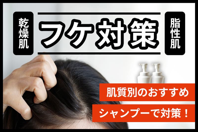 フケ対策シャンプーおすすめ人気16選【2026年8月】乾燥・脂性別の対策アイテムを紹介